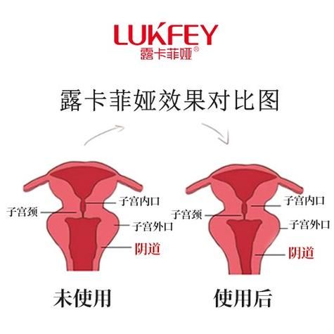 魔羯缩阴产品是真的吗_效果怎么样