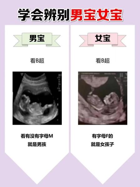 双子女生儿子几率大吗_双子女怀孕生男孩特征